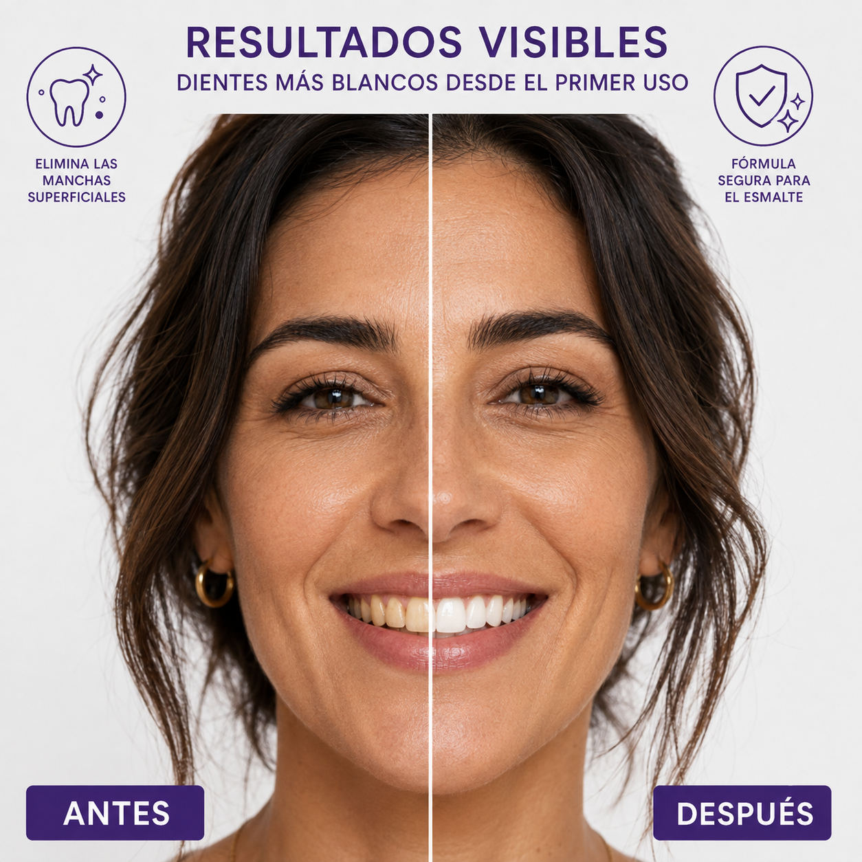 Comparativa antes y después de una rutina DR DENT