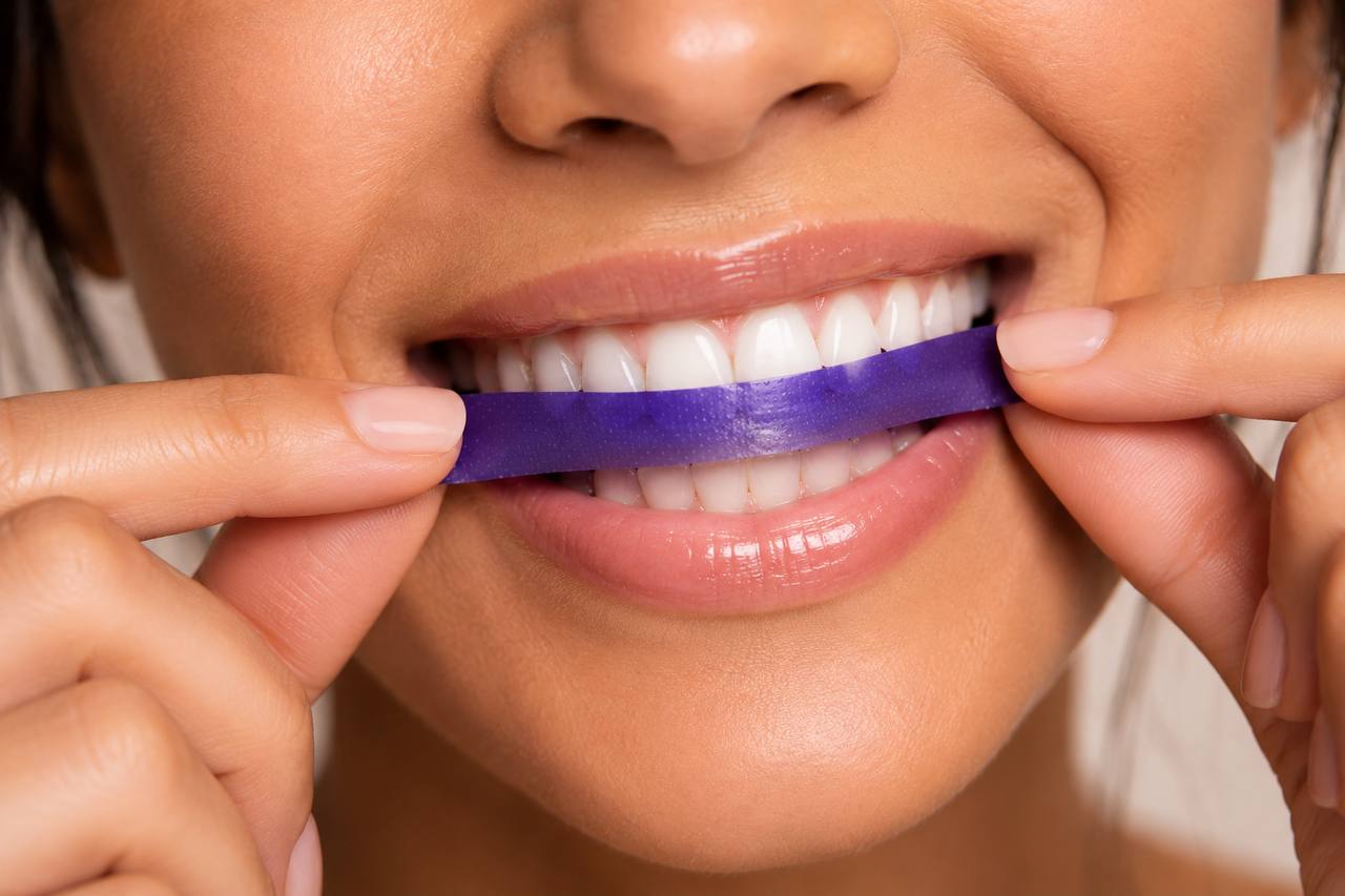 Aplicación de una tira blanqueadora DR DENT