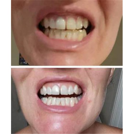 Foto compartida por Emma, clienta de DR DENT