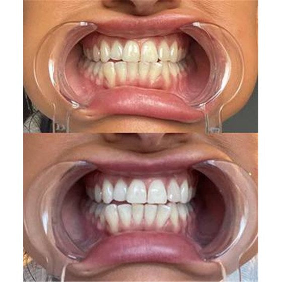 Foto compartida por Jeanne, clienta de DR DENT