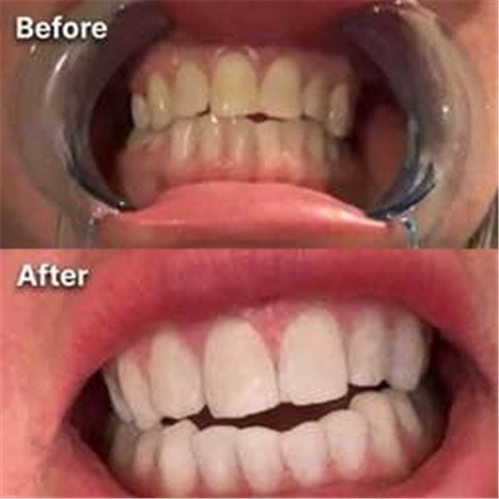 Foto compartida por Célia, clienta de DR DENT